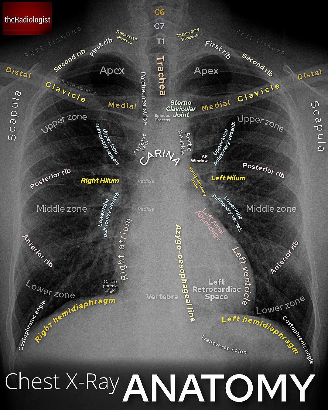 Radiological anatomy of a normal chest X-ray
