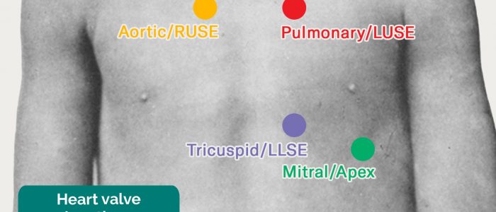 Paediatric heart valve auscultation areas