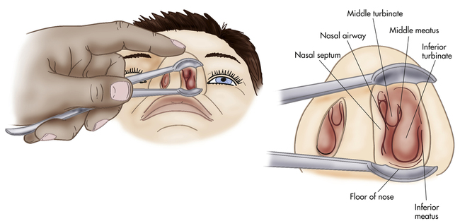 Normal Nasal View