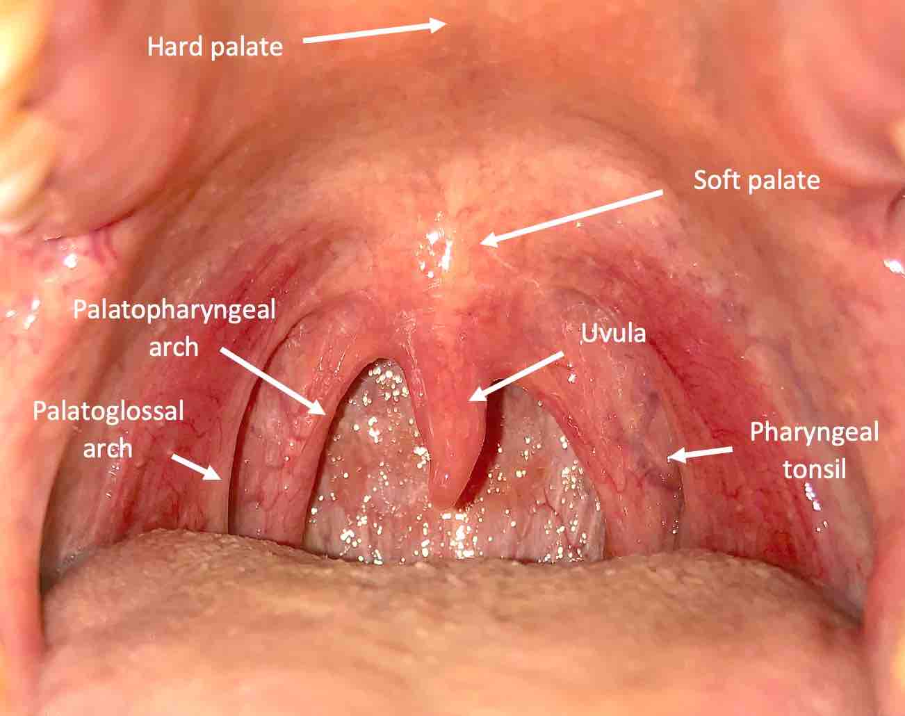 Normal Throat
